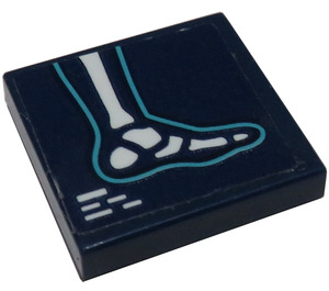LEGO Tile 2 x 2 with Foot X-Ray Sticker with Groove (3068)